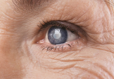 Learn the facts Diabetic Retinopathy